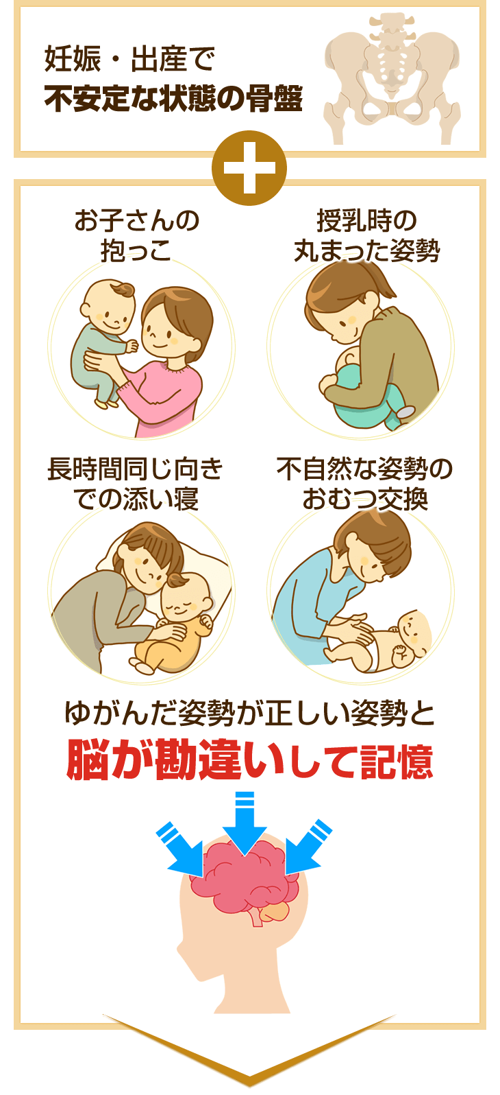 ゆがんだ姿勢が正しい姿勢と脳が勘違いして記憶